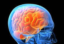 Dietary supplements for mind well being present no profit – a neurologist explains a brand new examine
